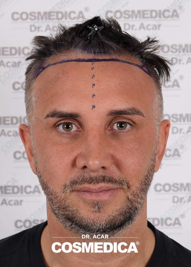 Keiran Lee at Cosmedica — photo 2