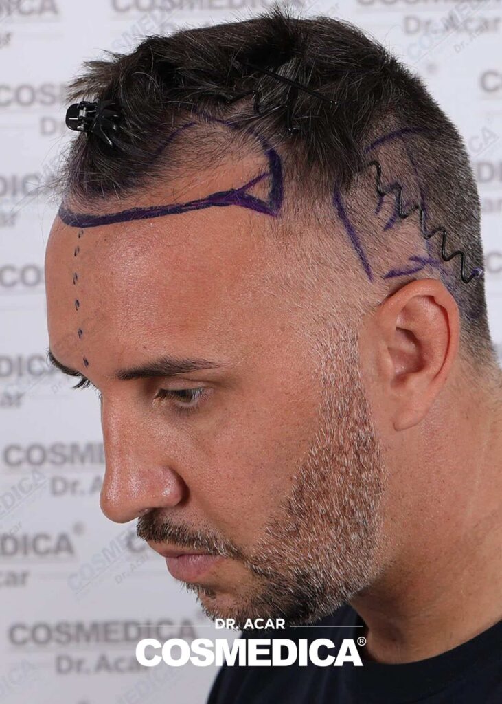 Keiran Lee at Cosmedica — photo 3