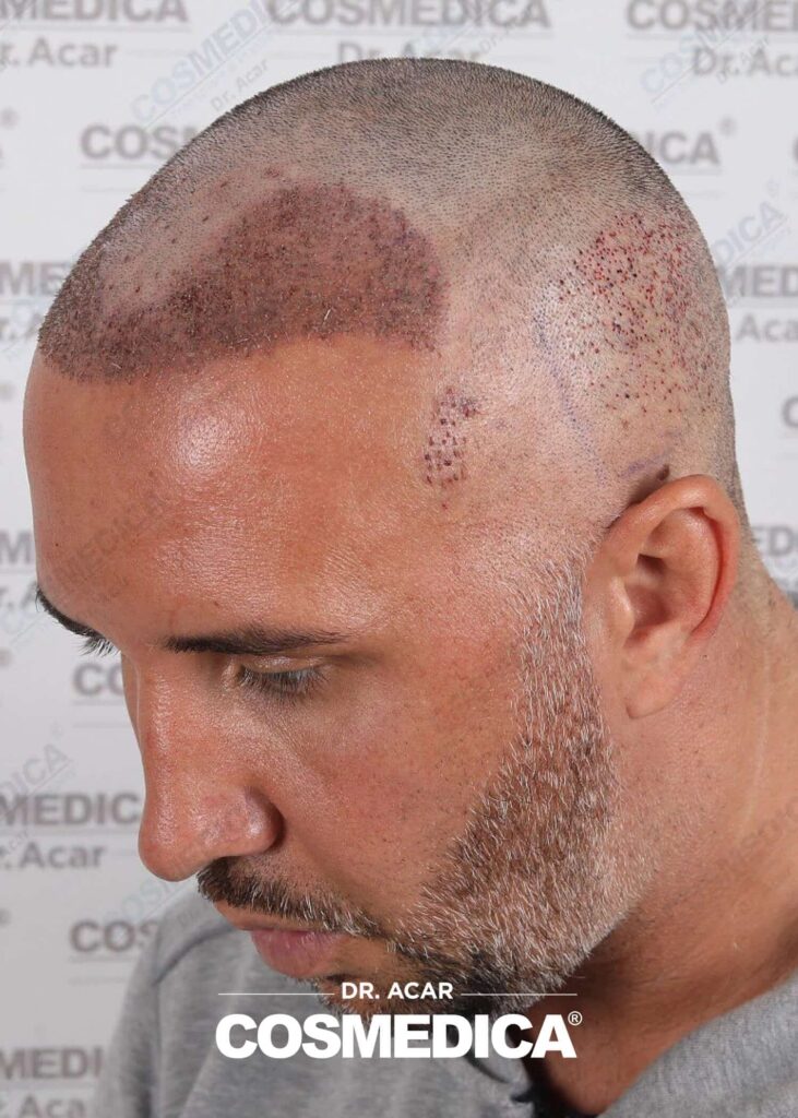 Keiran Lee at Cosmedica — photo 5